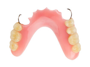 保険適用の精密義歯